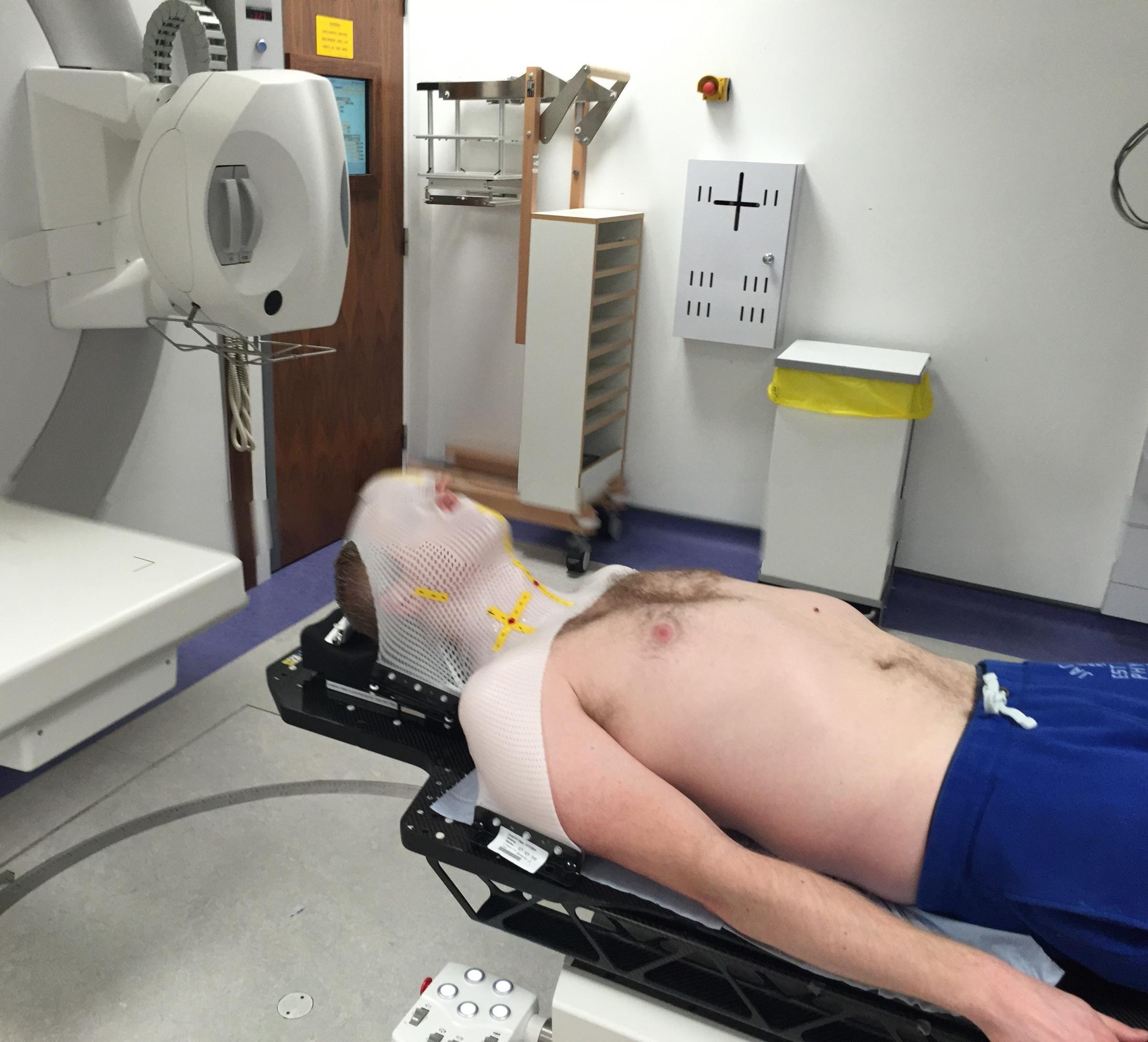 Steve Sweeney receiving radiotherapy at The Christie NHS Foundation Trust.